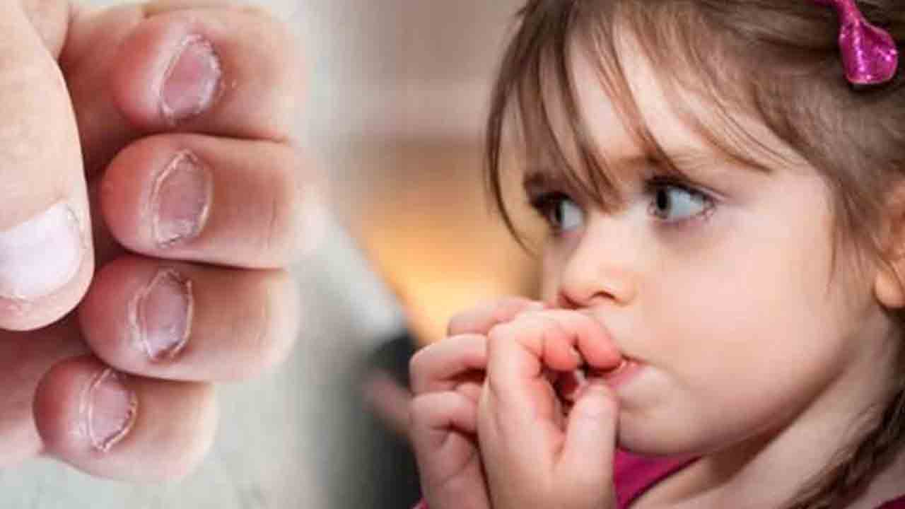 Tırnak yeme alışkanlığı neden olur ? 7