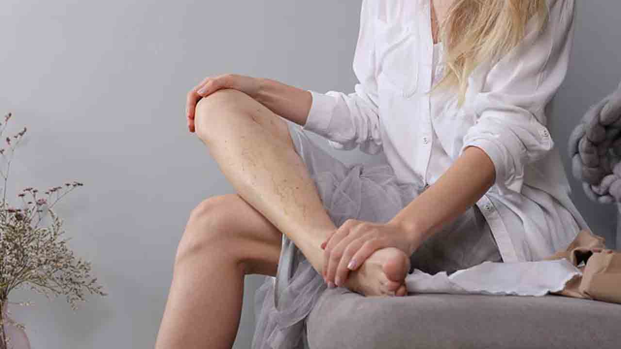 Sigaranın yol açtığı Buerger hastalığının 6 Önemli belirtisi 7