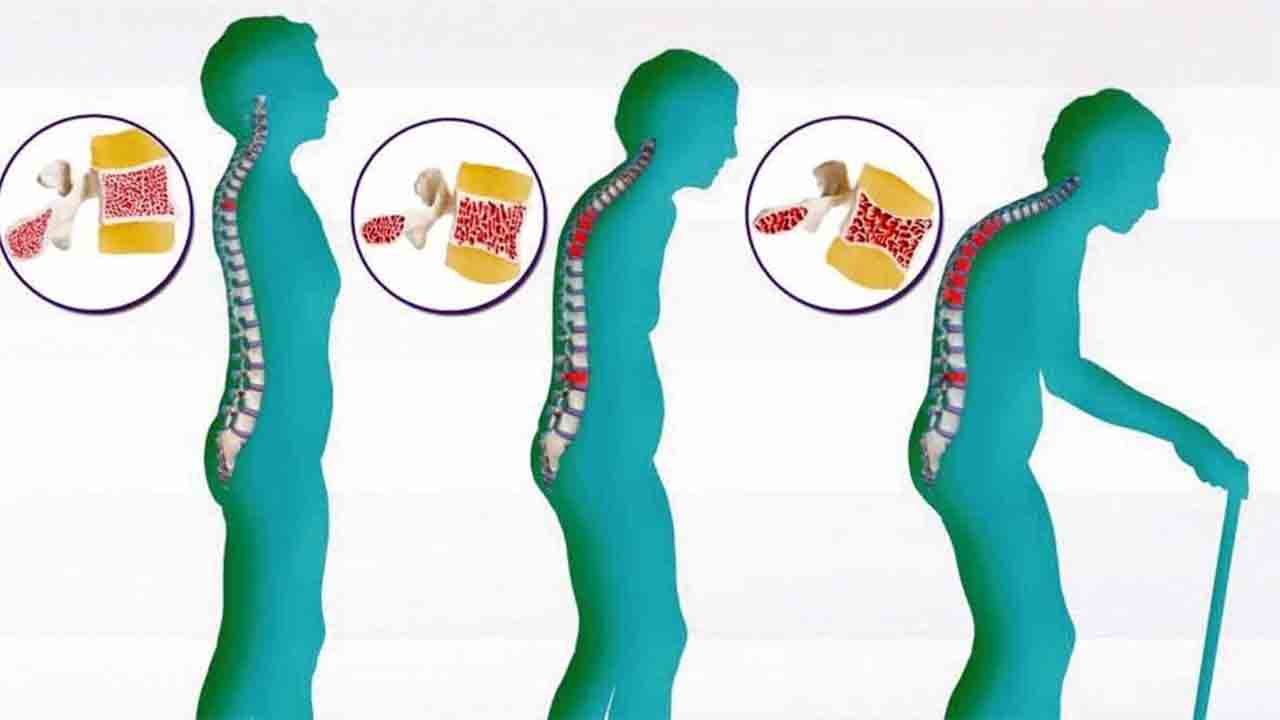 Osteoporoz riskini azaltacak 7 Önlem 7