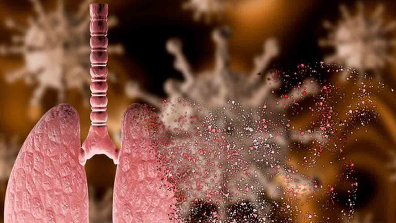 Akciğerlerde sertleşme solunum yetmezliğine yol açabilir! 7