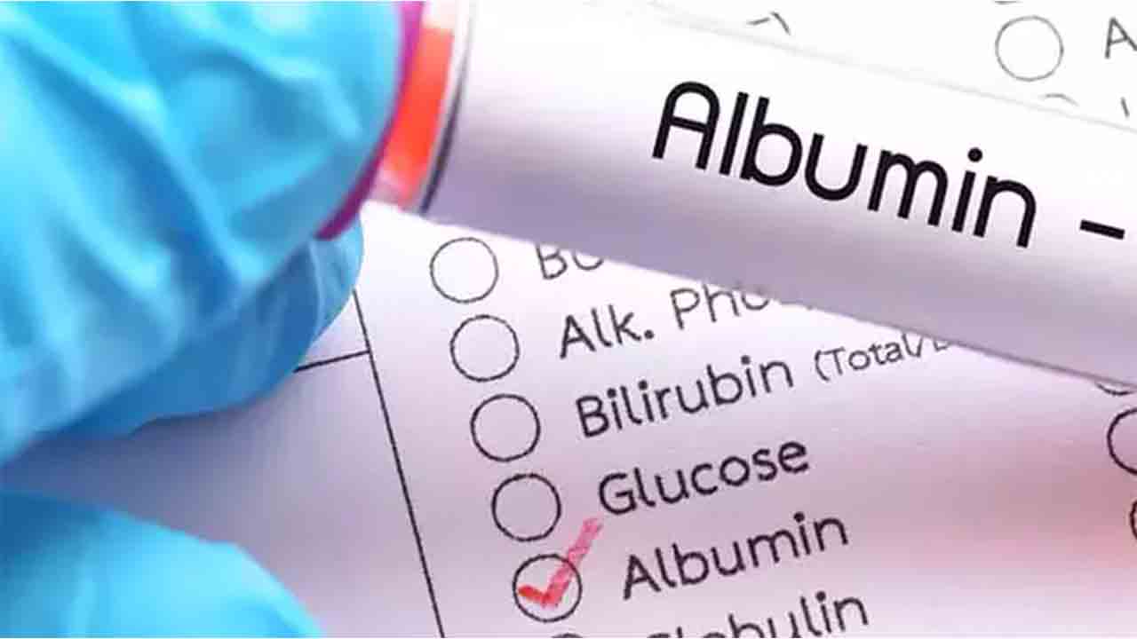 Albumin Yüksekliği 7
