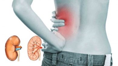 Böbrek iltihabının 7 önemli Belirtisi 1