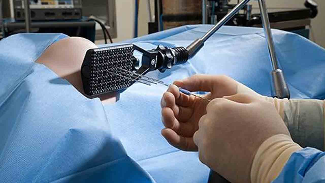 Brakiterapi nedir uygulama ve yan etkiler nelerdir 7