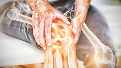 Deformite Cerrahisi nedir? 2