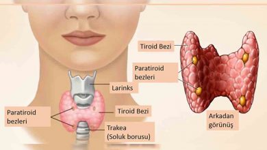 Tiroid nodüllerinde Kanser riskini göz ardı etmeyin 5