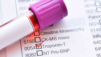 Troponin nedir? Değeri kaç olmalı? 1