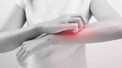 Giderek artan uyuz tehlikesine karşı önleminizi alın 1