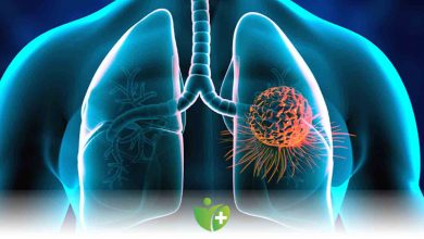 Her 30 saniyede 1 kişi akciğer kanserinden ölüyor 1