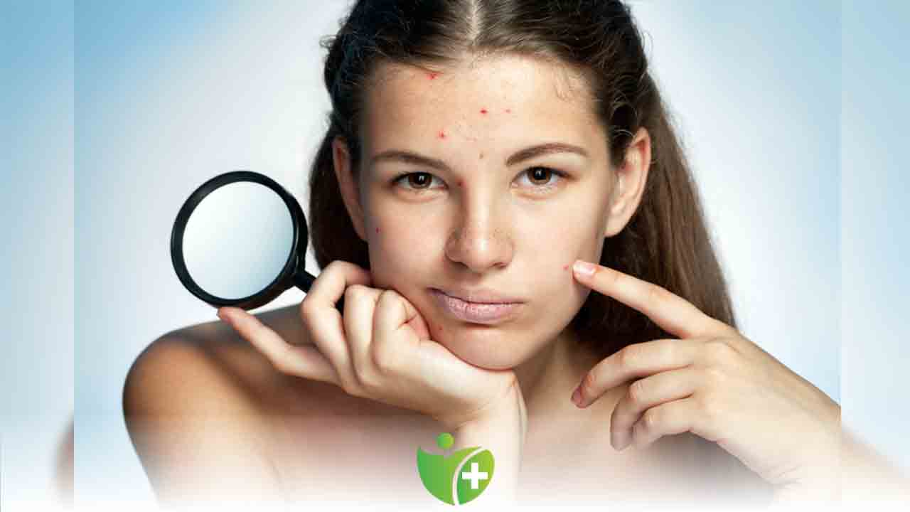 Dikkat! Bu hatalar akneleri tetikliyor! 7
