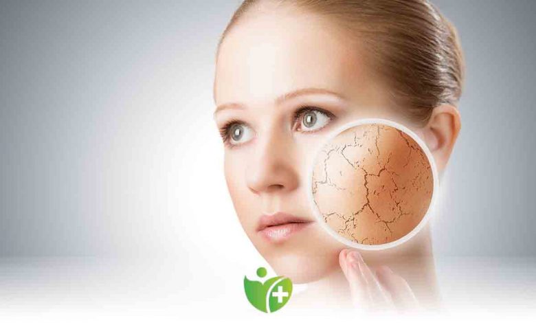 Kışın Cilt kuruluğunu önlemek için önemli öneriler 1