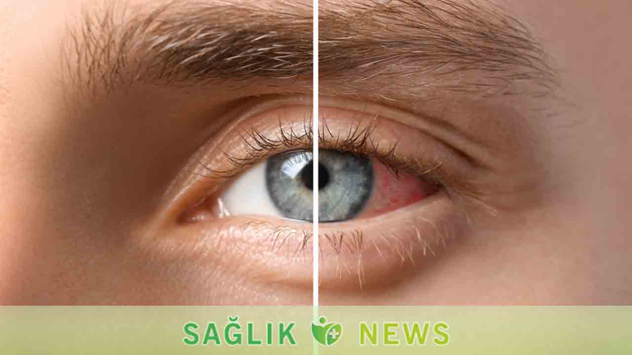 Diyabetiniz varsa Göz sağlığınız da risk altında 6