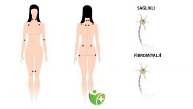 Fibromiyalji Kadınların yaşam kalitesini sıfıra indiriyor! 11