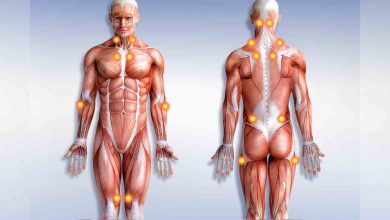 Fibromiyalji sendromu nedir? 1