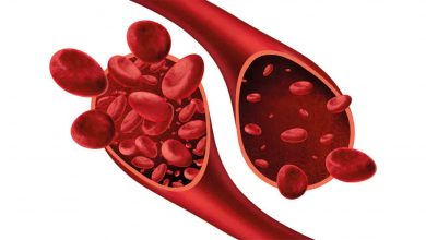 Kansızlığa ne iyi gelir? 1