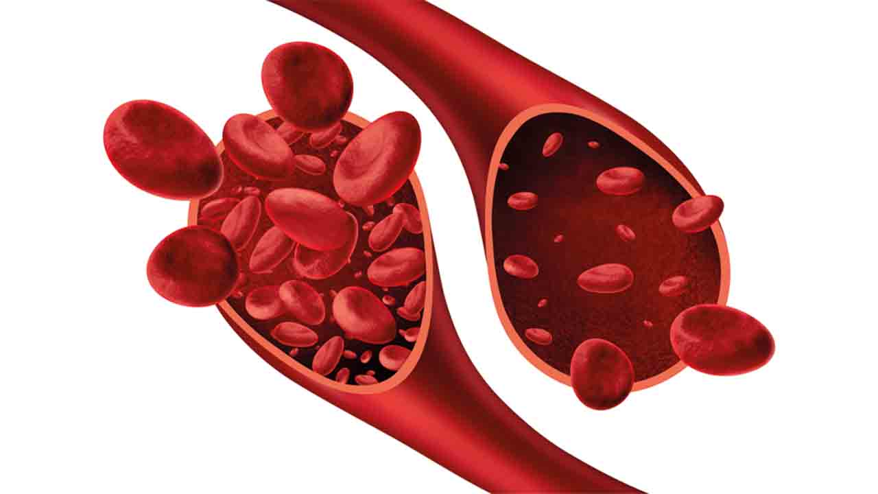 Kansızlığa ne iyi gelir? 7