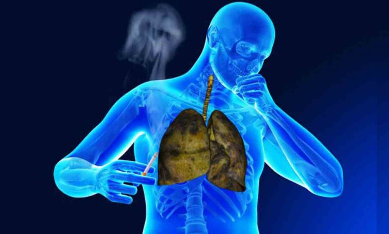 KOAH görülme oranı 40 yaş üzerinde artıyor 1