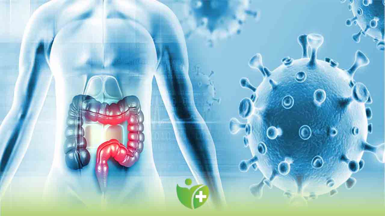 Kolon Kanserine yakalanma riskini artıran 8 faktör 7
