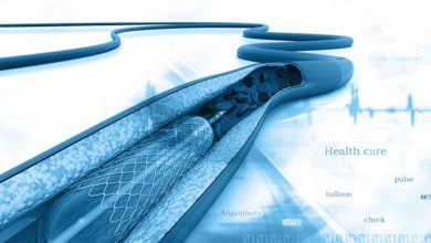 İlaç mı? Stent mi? Ameliyat mı? 5