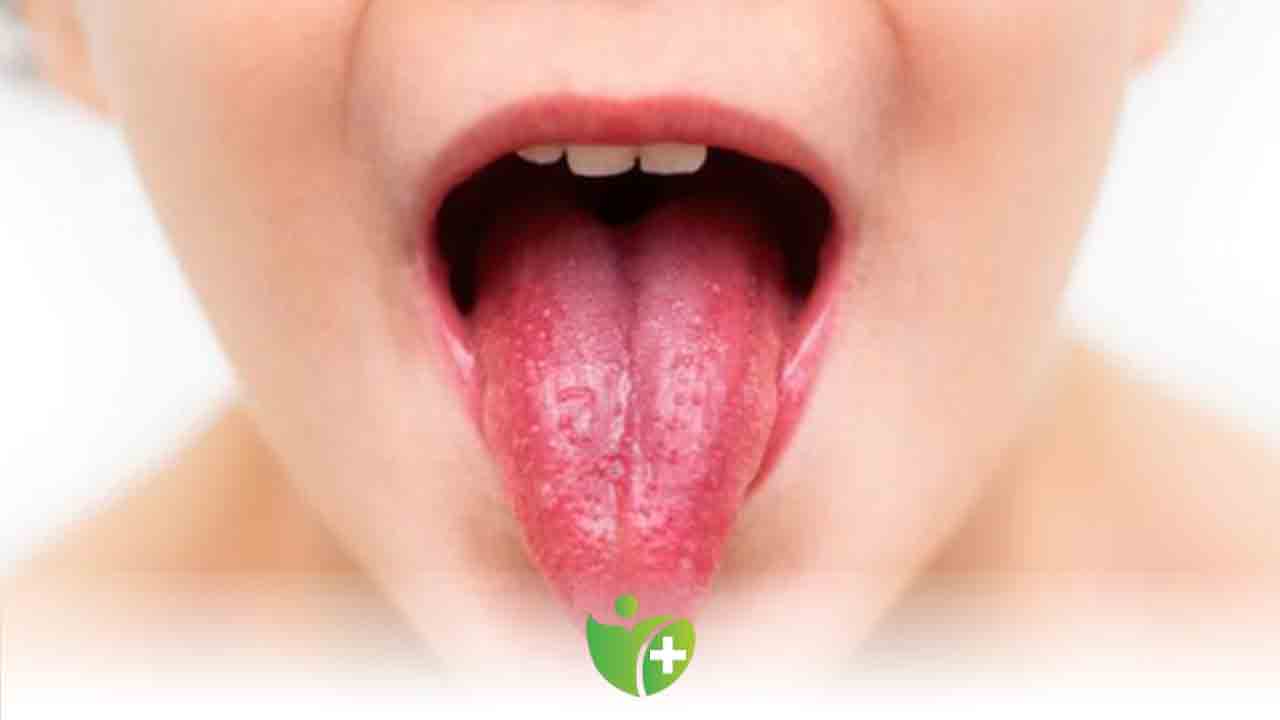 Kawasaki hastalığı nedir? Belirtileri nelerdir? 7