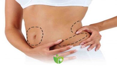 Bölgesel yağlanmaya karşı öneriler 4