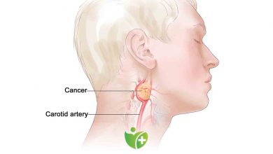 Boyun kitleleri büyük bir tehlikenin belirtisi olabilir! 1