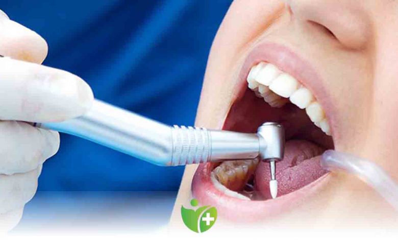 İmplant tedavisi diş çekiminden daha kolay 1