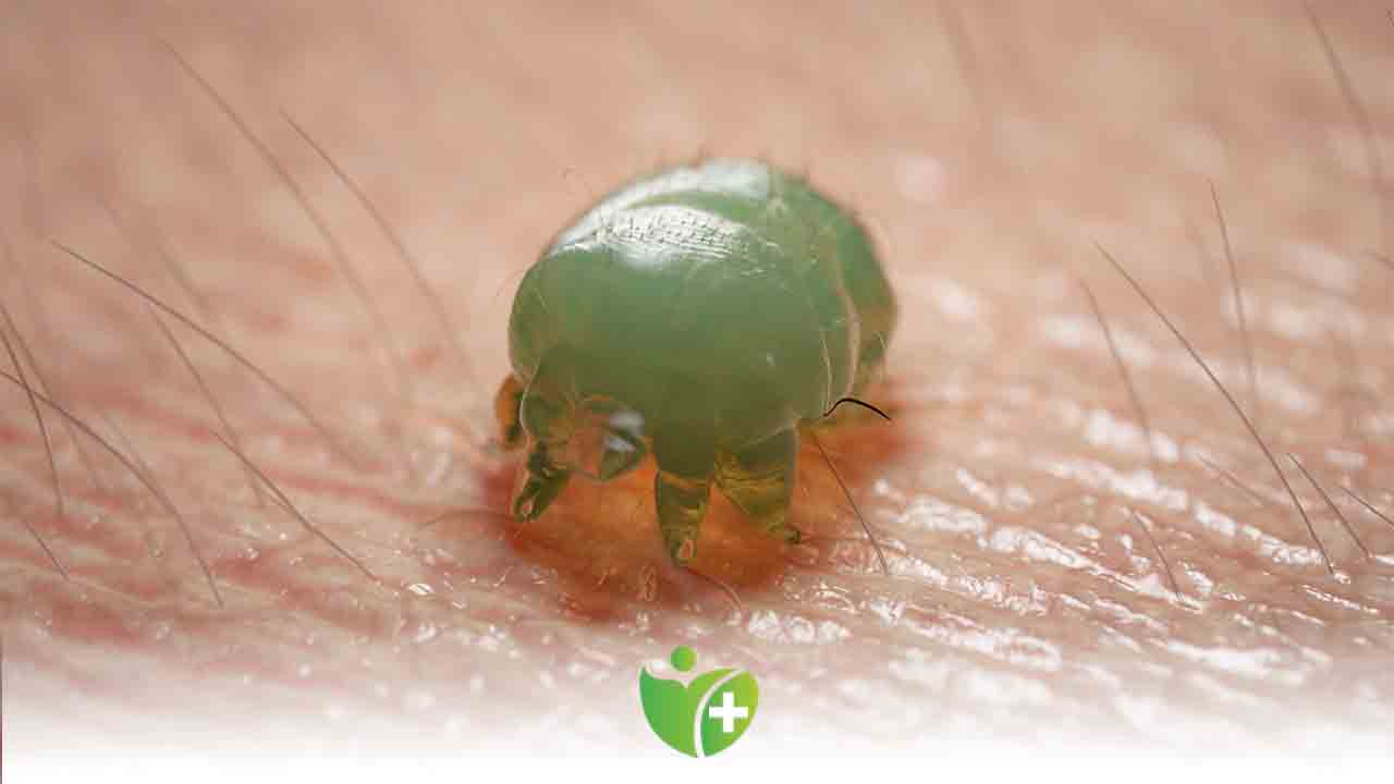 Uyuz salgını: Sebebi hayvanlar değil, Alışveriş! 7