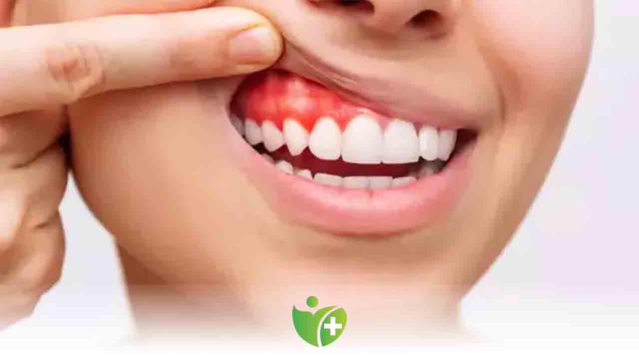 Günlük 10 sigaradan fazlası diş eti rahatsızlıklarına neden oluyor 7