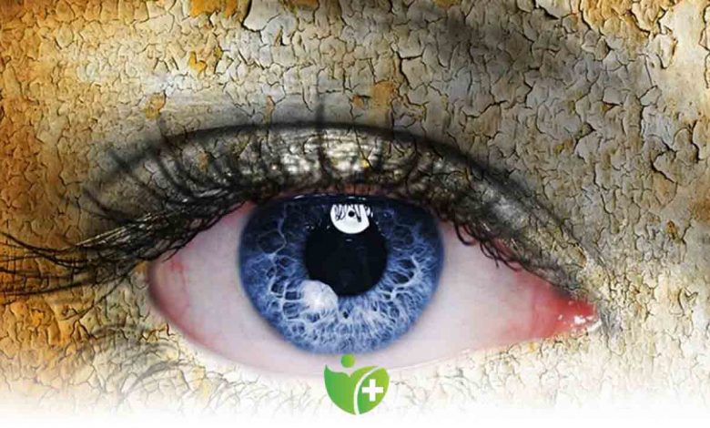 Kadınlar da görülen en sık göz problemlerine Dikkat! 1