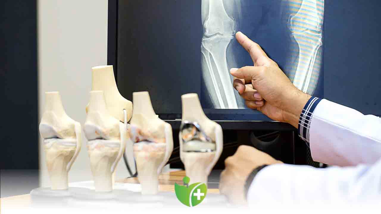 Menopoz döneminde Kemik Sağlığı açısından Kadınları neler bekliyor? 7