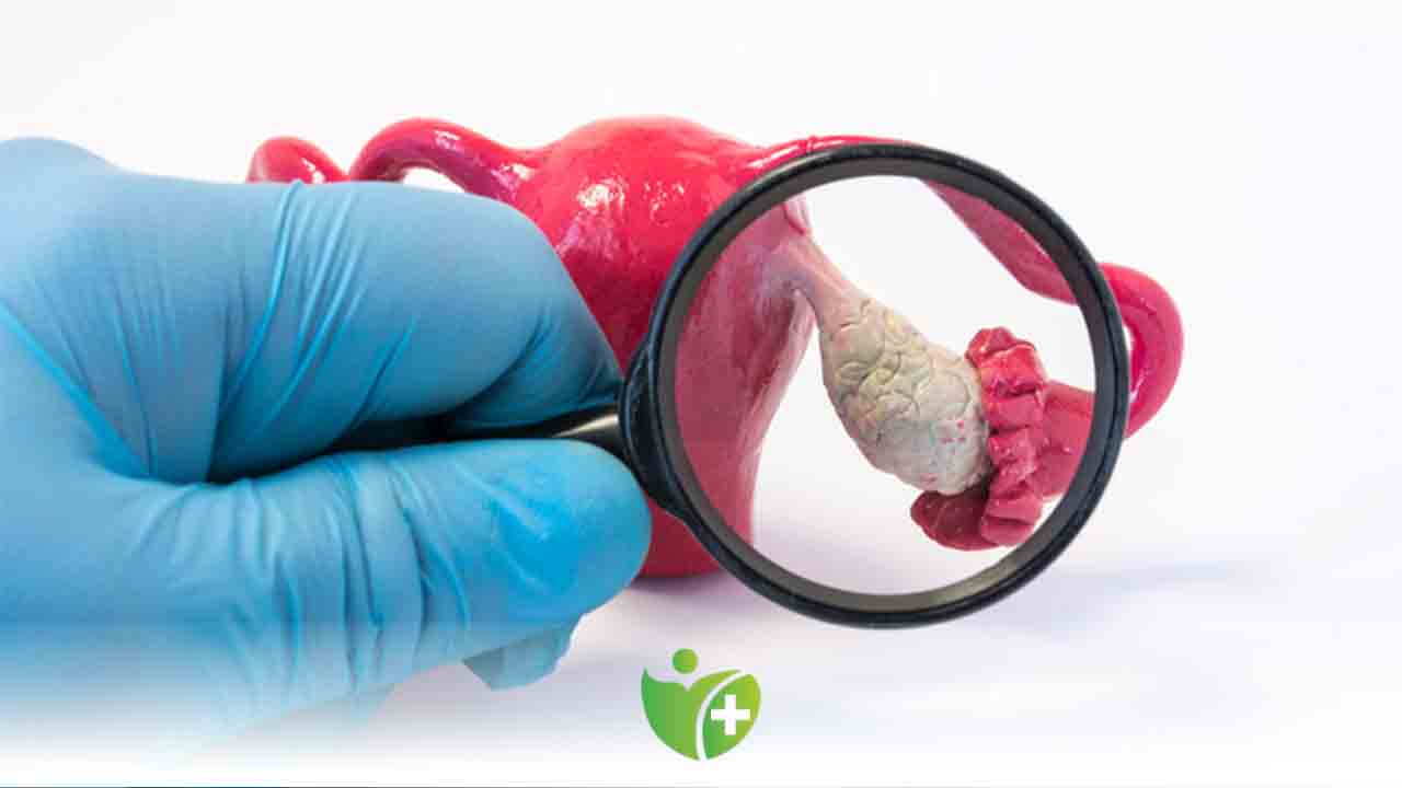 Polikistik Over Sendromu Hamileliğe engel değil 7