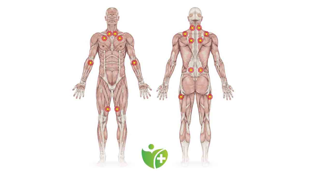 Kadınlar da Fibromiyalji Sorununa Dikkat! 7