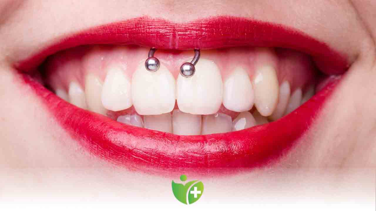 Ağız içi Piercing ve Diş Pırlantaları diş sağlığını etkiliyor 7