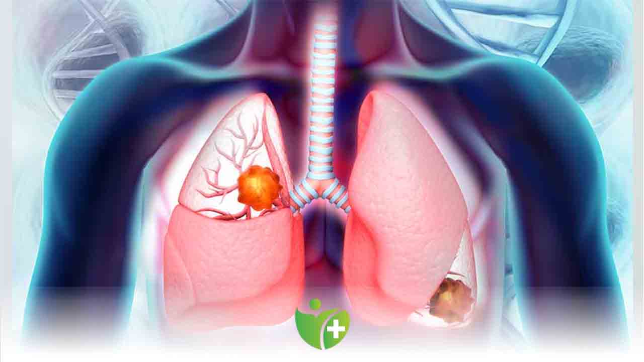 Akciğere bıçak değmez inanışı yanlış 7