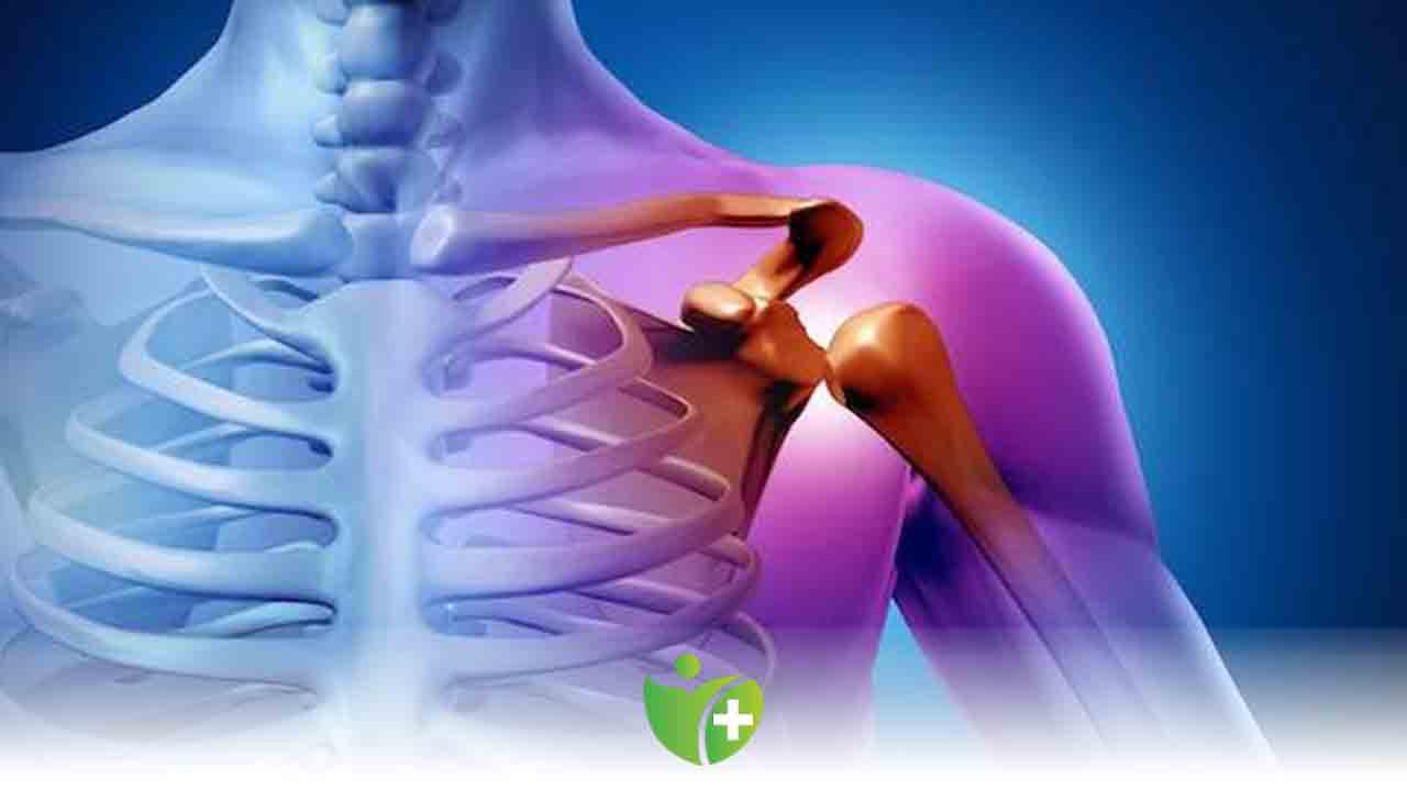 Omuz Sıkışması Sendromu nedir? 7