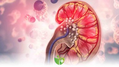 Böbrek taşına yol açan 8 önemli hata! 6