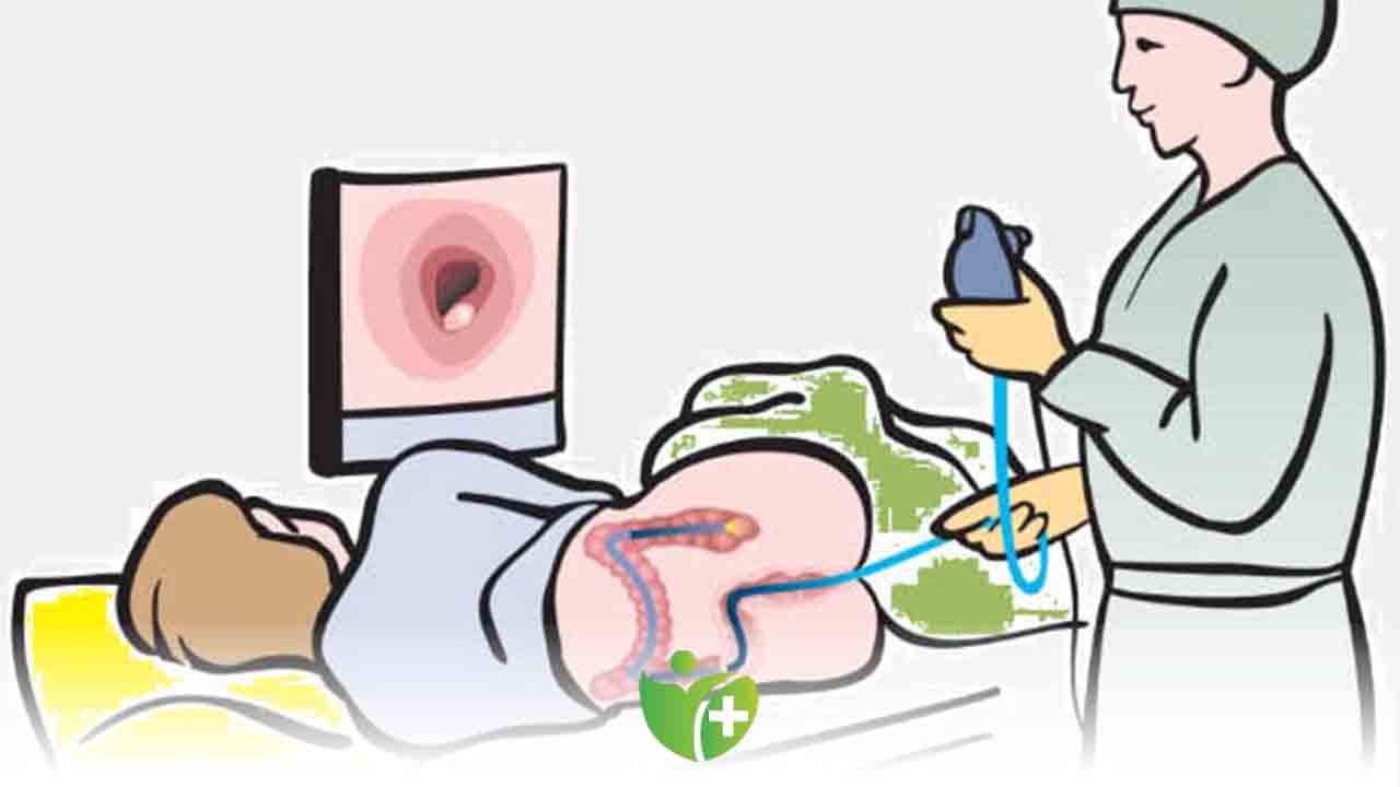 Uzmanlar uyardı! 45 yaş üzerindeki herkes kolonoskopi yaptırmalı! 7