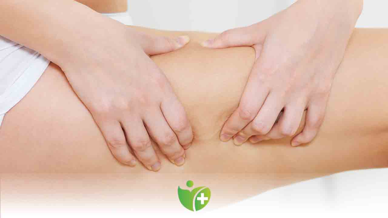 Bunlar selülit oluşumunu tetikliyor ! 6