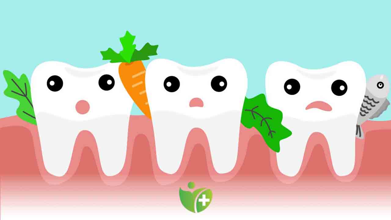 Bir bayram klasiği şeker dişlere zarar vermeden nasıl tüketilmeli? 7