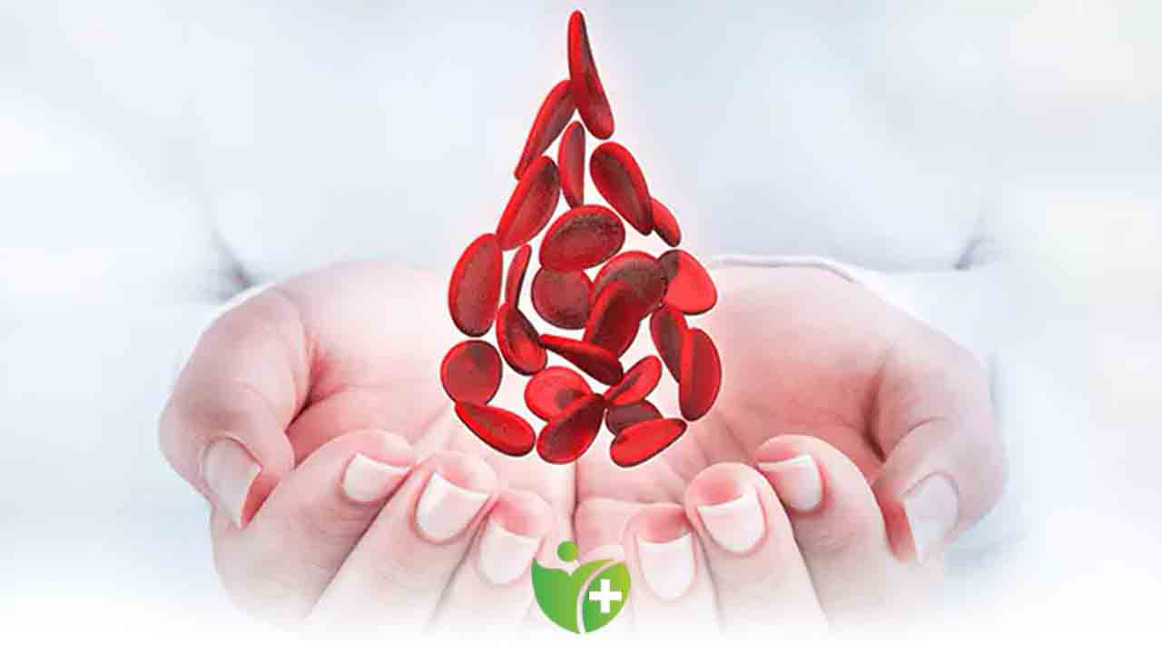 Akdeniz Anemisi olabilir misiniz? 7