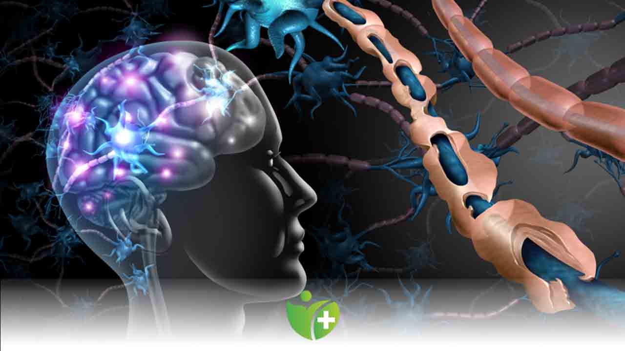 MS (Multipl Skleroz) Hakkında bilinmesi gereken 9 önemli nokta 7