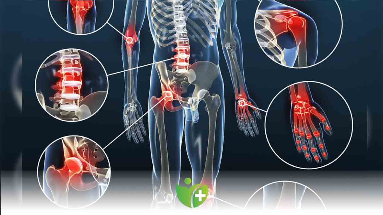 Fibromiyalji sendromu çene eklem hastalarını tetikliyor! 7