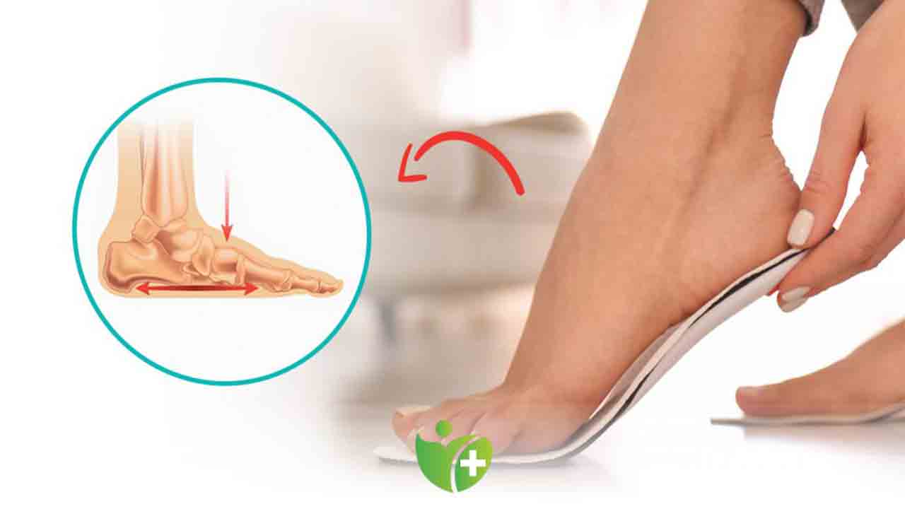 Çocuklarda düz tabanlık belirtilerine Dikkat ! 7