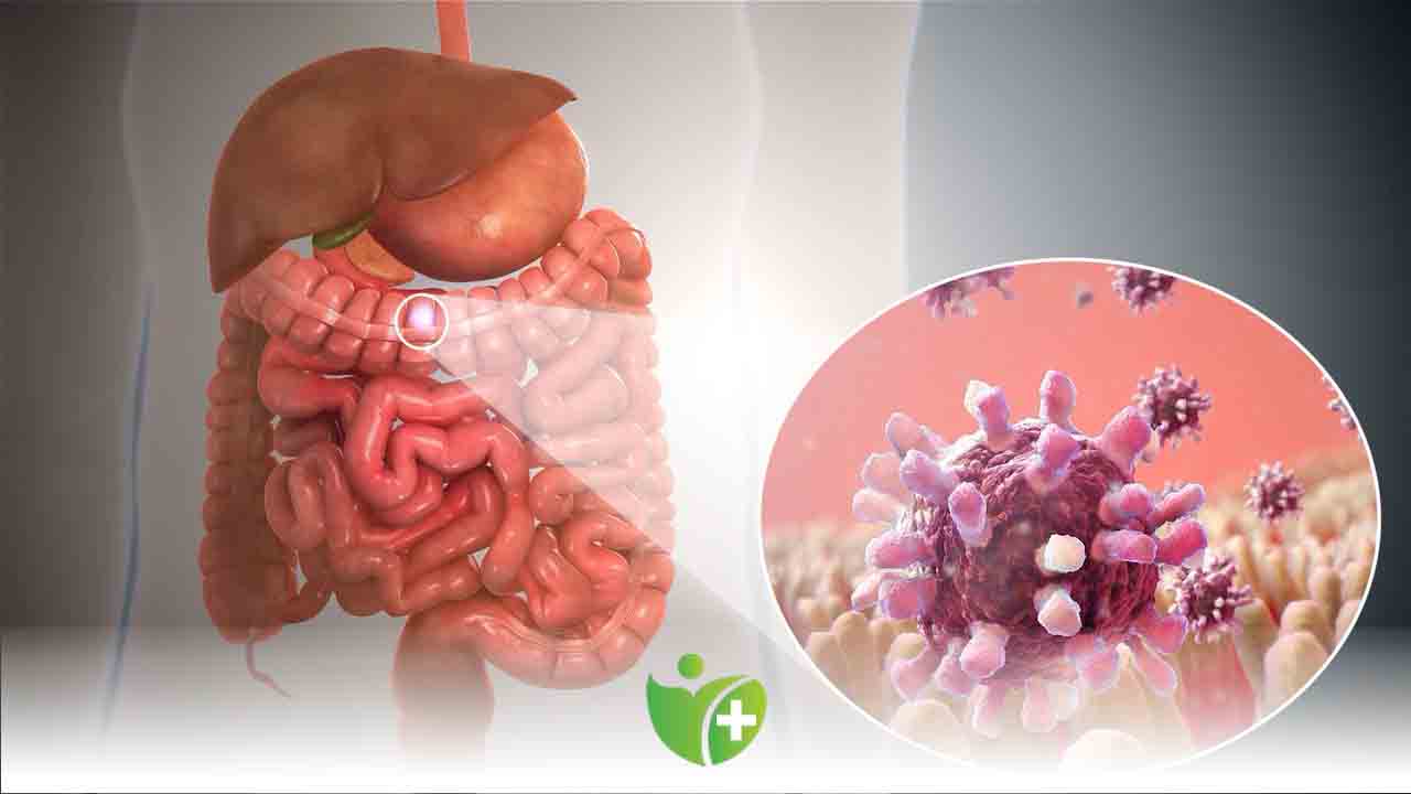 Gastroenteritin 6 önemli belirtisi 7