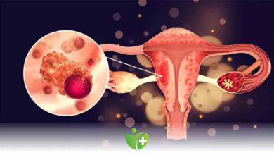 Jinekolojik Kanserler Tedavi edilmezse Risklere yol açabilir 2