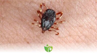 Sıcak havalarda Kırım Kongo vakalarına Dikkat! 3