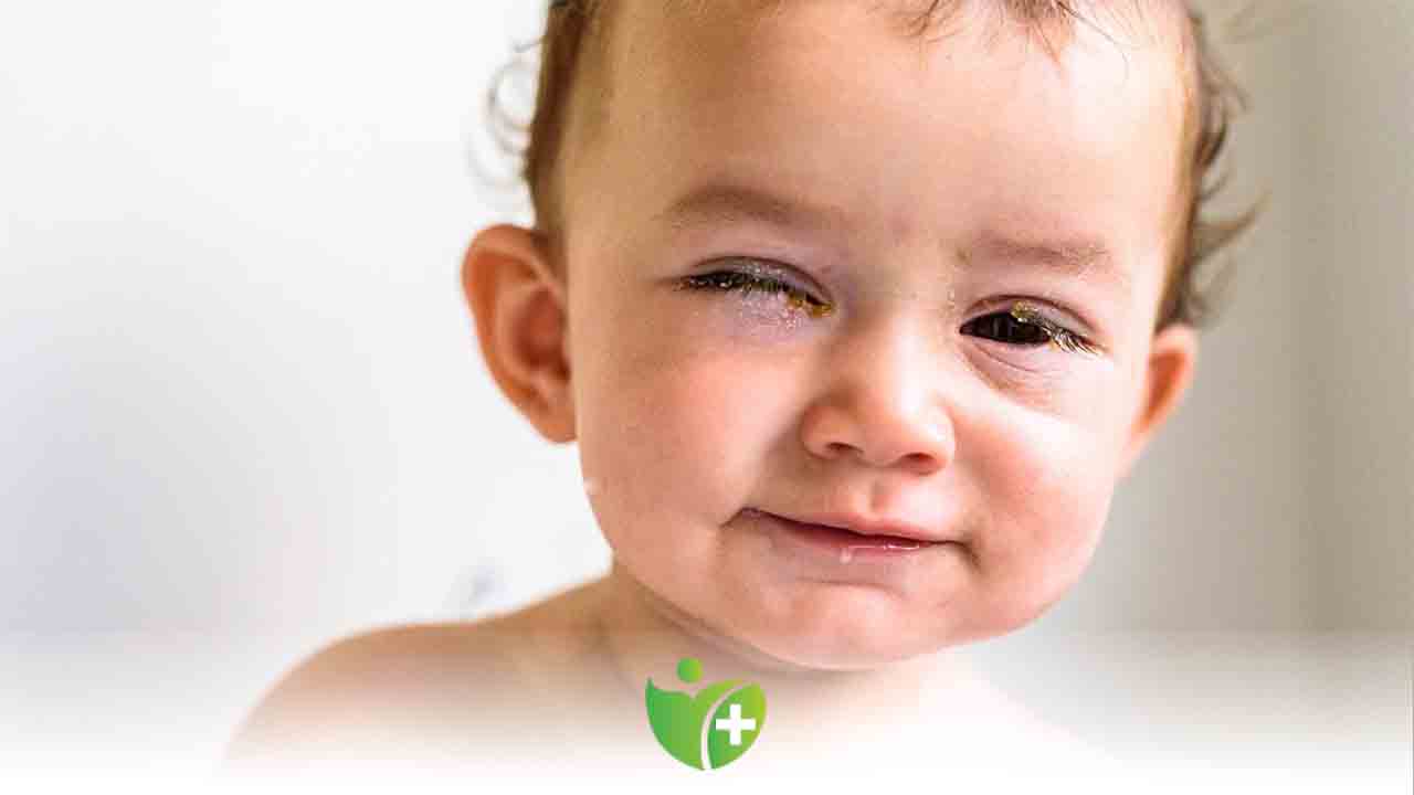 Çocuklar da Göz Enfeksiyonlarına Dikkat! 7