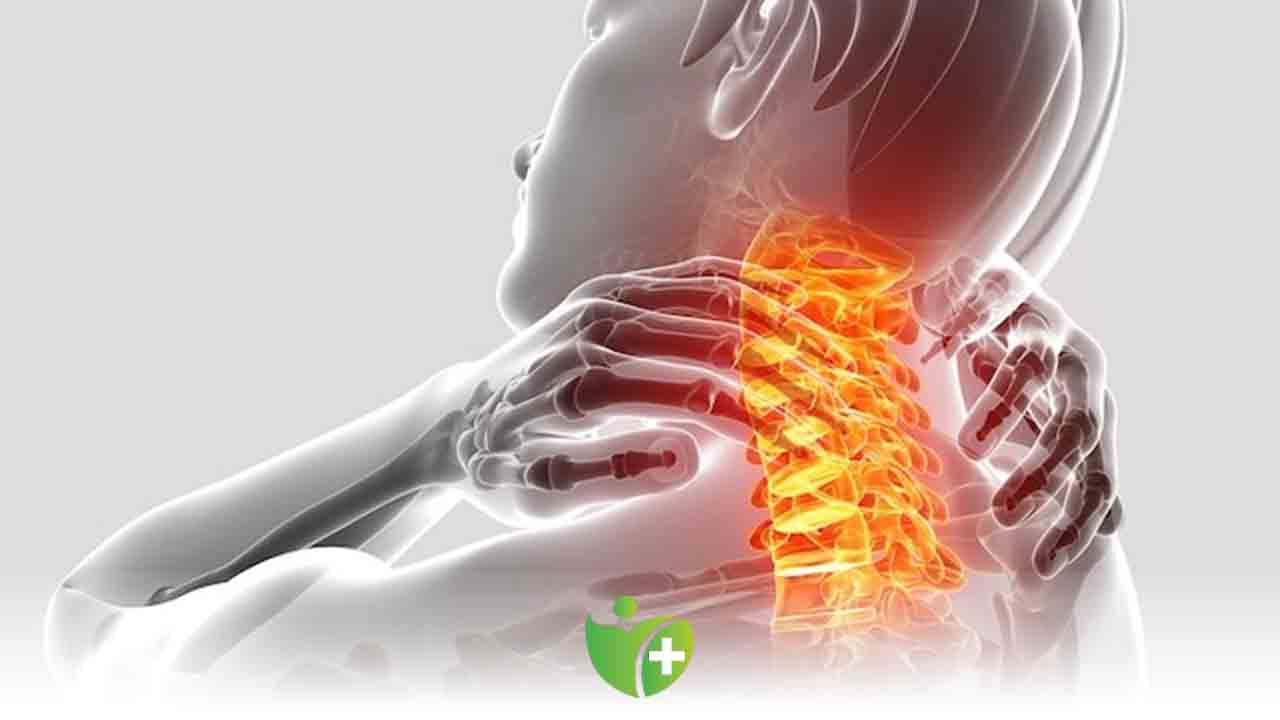 Boyun fıtığı hakkında bilinmesi gereken 6 önemli nokta 7