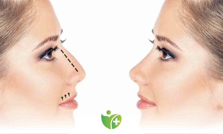 Uzmanı uyardı! ‘Normal’ bir burun tercih edilmeli 1