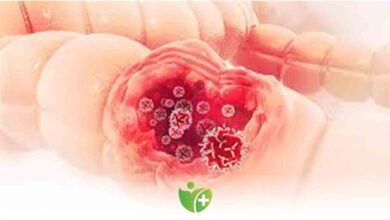 Kalın bağırsak kanseri, en sık görülen 3. kanser! 8